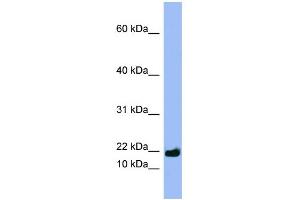 WB Suggested Anti-SPRR3 Antibody Titration:  0. (SPRR3 Antikörper  (Middle Region))