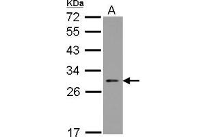 Western Blotting (WB) image for anti-Nucleolar Protein 3 (Apoptosis Repressor with CARD Domain) (NOL3) (AA 1-197) antibody (ABIN1501899) (NOL3 Antikörper  (AA 1-197))