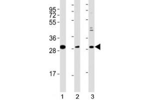 Western blot testing of Nkx2. (NK2 Homeobox 5 Antikörper  (AA 98-133))