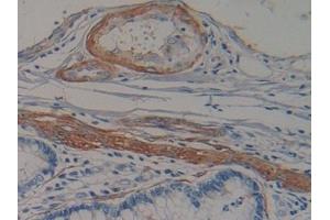 Immunohistochemistry (IHC) image for anti-Pro-Atrial Natriuretic Peptide (PRO-ANP) (AA 25-123) antibody (ABIN7431869)