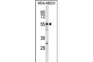 CABIN486182 and ABIN1535563 Antibody (N-term) (ABIN657088 and ABIN2837891) western blot analysis in MDA-M cell line lysates (35 μg/lane).