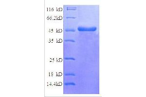 NADH Dehydrogenase (Ubiquinone) Flavoprotein 2, 24kDa (NDUFV2) (AA 35-249), (partial) protein (GST tag) (NDUFV2 Protein (AA 35-249, partial) (GST tag))