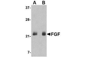Western blot analysis of FGF4 in NIH 3T3 cell lysate with AP30336PU-N FGF4 antibody at (A) 0.