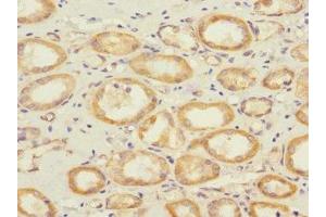 Immunohistochemistry of paraffin-embedded human kidney tissue using ABIN7166096 at dilution of 1:100 (SAV1 Antikörper  (AA 1-210))