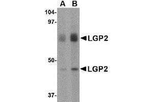 Western blot analysis of LGP2 in rat kidney tissue lysate with LGP2 antibody at (A) 1 and (B) 2 µg/ml. (DHX58 Antikörper  (Center))