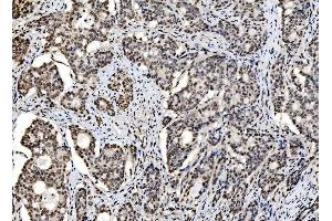 IHC analysis of DBC-1/CCAR2 using anti-DBC-1/CCAR2 antibody (ABIN7602235).