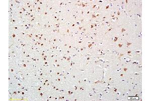 Formalin-fixed and paraffin embedded human brain labeled with Anti-HDAC10 Polyclonal Antibody, Unconjugated (ABIN681298) at 1:200 followed by conjugation to the secondary antibody and DAB staining