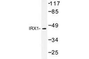 Western blot analysis of IRX1 antibody in extracts from LOVO cells.
