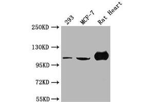 Western Blot Positive WB detected in: 293 whole cell lysate, MCF-7 whole cell lysate, Rat Heart tissue All lanes: ACTN2 antibody at 1:2000 Secondary Goat polyclonal to rabbit IgG at 1/50000 dilution Predicted band size: 104 kDa Observed band size: 104 kDa (ACTN2 Antikörper  (AA 1-301))