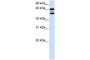 Western Blotting (WB) image for anti-F-Box Protein 21 (FBXO21) antibody (ABIN2458715) (FBXO21 Antikörper)
