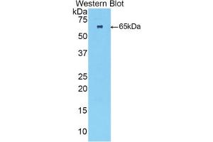 Detection of Recombinant TNNC2, Human using Polyclonal Antibody to Troponin C Type 2, Fast (TNNC2) (TNNC2 Antikörper  (AA 2-160))