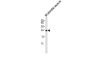 Western blot analysis of lysate from human skeletal muscle tissue lysate, using TME Antibody (N-term) (ABIN6244271 and ABIN6577475). (TMEM239 Antikörper  (N-Term))