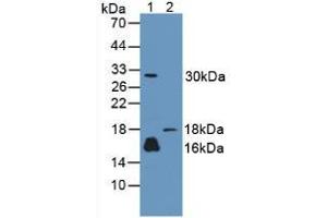 Western blot analysis of (1) Human A431 Cells and (2) Rat Skin Tissue. (CALML3 Antikörper  (AA 1-149))