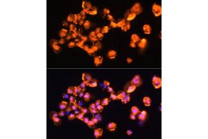 Immunofluorescence analysis of  cells using PRKCB antibody (ABIN6128463, ABIN6146200, ABIN6146202 and ABIN6221544) at dilution of 1:100. (PKC beta Antikörper  (AA 220-340))