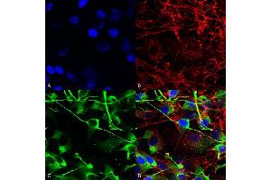 Immunocytochemistry/Immunofluorescence analysis using Mouse Anti-GluN2A/NR2A Monoclonal Antibody, Clone S327-95 (ABIN2483884). (NMDAR2A Antikörper  (AA 75-325) (PE))