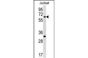 Western blot analysis in Jurkat cell line lysates (35ug/lane). (SMARCD1 Antikörper  (C-Term))