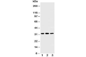Western blot testing of SDHB antibody and Lane 1:  rat testis;  2: rat heart;  3: Jurkat cell lysate.