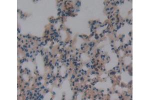IHC-P analysis of lung tissue, with DAB staining. (DOK3 Antikörper  (AA 160-409))
