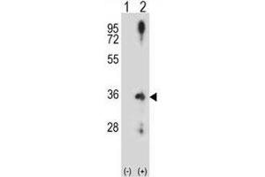 Western blot analysis of Cyclin D2 antibody and 293 cell lysate (2 ug/lane) either nontransfected (Lane 1) or transiently transfected (2) with the CCND2 gene. (Cyclin D2 Antikörper  (AA 1-30))