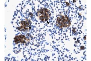 ZNF21 antibody was used for immunohistochemistry at a concentration of 4-8 ug/ml to stain Epithelial cells of pancreatic acinus (lndicated with Arrows) in Human Pancreas. (ZNF182 Antikörper  (Middle Region))