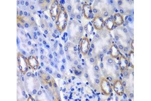 Immunohistochemistry of paraffin-embedded Mouse kidney using MATK Polyclonal Antibody at dilution of 1:100 (40x lens). (MATK Antikörper)