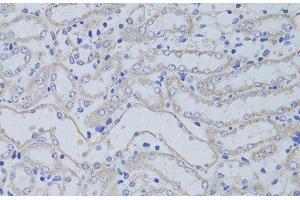 Immunohistochemistry of paraffin-embedded Mouse kidney using AQP5 Polyclonal Antibody at dilution of 1:50 (40x lens). (Aquaporin 5 Antikörper)