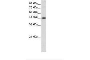 Image no. 1 for anti-Transcription Factor AP-2 beta (Activating Enhancer Binding Protein 2 Beta) (TFAP2B) (AA 372-421) antibody (ABIN202550) (TFAP2B Antikörper  (AA 372-421))