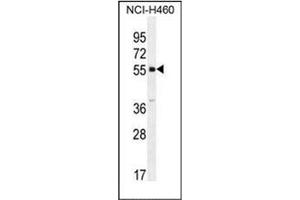 Western blot analysis of SHISA6 Antibody (N-term) in NCI-H460 cell line lysates (35ug/lane). (SHISA6 Antikörper  (N-Term))