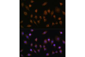 Immunofluorescence analysis of L929 cells using SNX1 Rabbit pAb (ABIN6128725, ABIN6148234, ABIN6148235 and ABIN6224727) at dilution of 100 (40x lens).