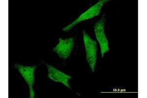 Immunofluorescence of purified MaxPab antibody to RIOK2 on HeLa cell. (RIOK2 Antikörper  (AA 1-552))