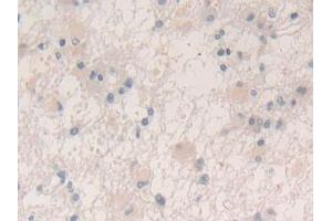 Immunohistochemistry (IHC) image for anti-Vascular Endothelial Growth Factor A (VEGFA) (AA 28-147) antibody (ABIN7429445)