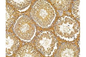 ABIN7095707 and ABIN7099769 at 1/100 staining rat testis tissue by IHC-P.
