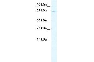 WB Suggested Anti-TGFB1I1 Antibody Titration: 0. (TGFB1I1 Antikörper  (Middle Region))