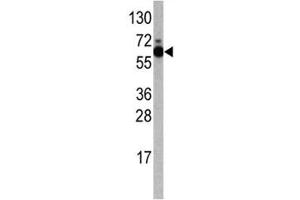 Western blot analysis of S6K antibody and Jurkat lysate.