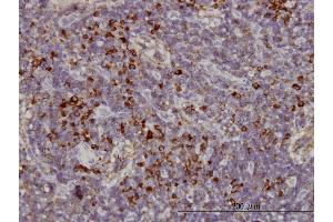 Immunoperoxidase of monoclonal antibody to KIFC1 on formalin-fixed paraffin-embedded human lymph node. (KIFC1 Antikörper  (AA 53-152))