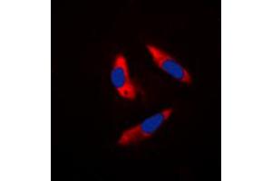 Immunofluorescent analysis of S6K1 staining in Hela cells. (RPS6KB1 Antikörper  (Center))