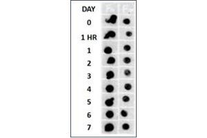 Beta Amyloid HEPES-NaCl aggregation, showing 1/500 (Left) and 1/5000 (Right) time lapse dot blot. (Amyloid Fibrils Antikörper)