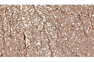 Detection of GFAP in Rat Spinal cord Tissue using Polyclonal Antibody to Glial Fibrillary Acidic Protein (GFAP) (GFAP Antikörper  (AA 1-430))