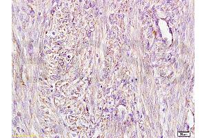 Immunohistochemistry (IHC) image for anti-alpha-Fetoprotein (AFP) antibody (ABIN722916) (alpha Fetoprotein Antikörper)