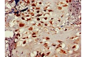 Immunohistochemistry of paraffin-embedded human placenta tissue using ABIN7158837 at dilution of 1:100 (LOXL2 Antikörper  (AA 27-121))