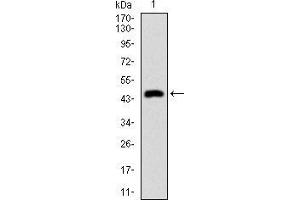 Western blot analysis using CK5 mAb against human CK5 recombinant protein. (Cytokeratin 5 Antikörper  (AA 316-590))