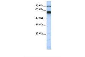 Image no. 1 for anti-Matrix Metallopeptidase 16 (Membrane-inserted) (MMP16) (AA 72-121) antibody (ABIN6738261) (MMP16 Antikörper  (AA 72-121))
