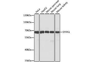 Western blot analysis of extracts of various cell lines, using SYVN1 antibody. (SYVN1 Antikörper  (C-Term))