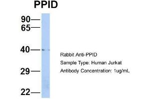 Host: Rabbit  Target Name: PPID  Sample Tissue: Human Jurkat  Antibody Dilution: 1. (PPID Antikörper  (Middle Region))