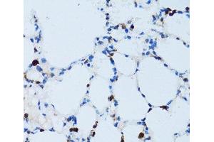 Immunohistochemistry of paraffin-embedded Mouse lung using SPN Polyclonal Antibody at dilution of 1:100 (40x lens). (CD43 Antikörper)