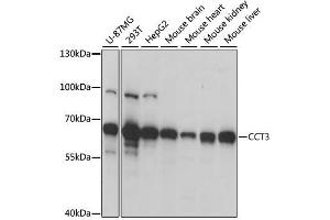 Western blot analysis of extracts of various cell lines, using CCT3 antibody. (CCT3 Antikörper  (AA 1-300))