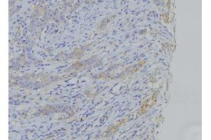 ABIN6273503 at 1/100 staining Human gastric tissue by IHC-P. (Cytochrome b Antikörper  (N-Term))