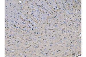 IHC analysis of MST3/STK24 using anti-MST3/STK24 antibody (ABIN7599389). (STK24 Antikörper  (AA 1-433))