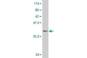 Western Blot detection against Immunogen (36. (SMAD6 Antikörper  (AA 285-384))