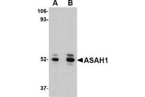 Western blot analysis of ASAH1 in mouse heart tissue lysate with ASAH1 antibody at (A) 1 and (B) 2 μg/ml.